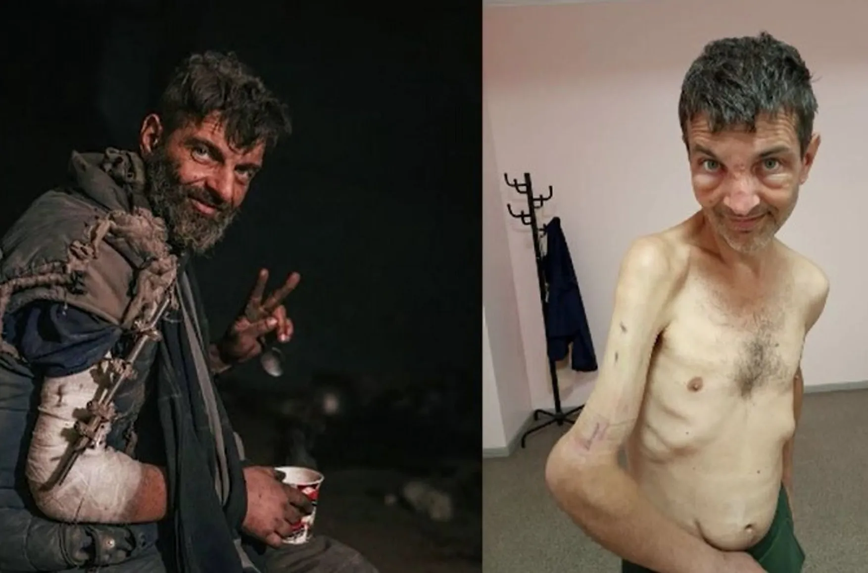 Starved, beaten, tasered: returned Azovstal defender recounts torture in Russian captivity